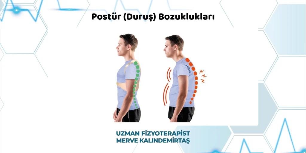 Postür (Duruş) Bozuklukları