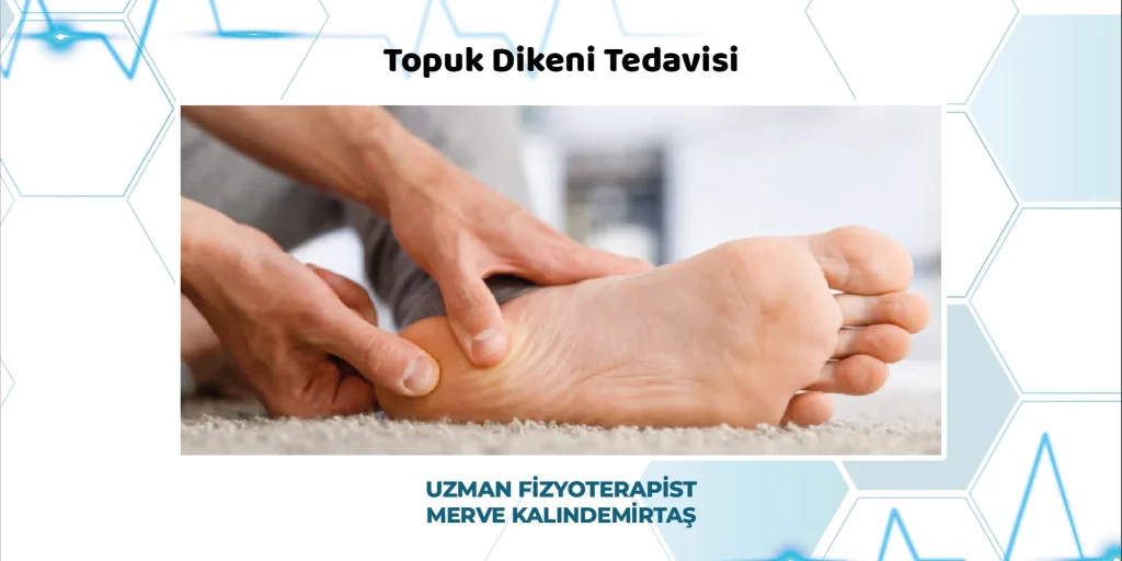 Fizyoterapi Topuk Dikeni Tedavisi