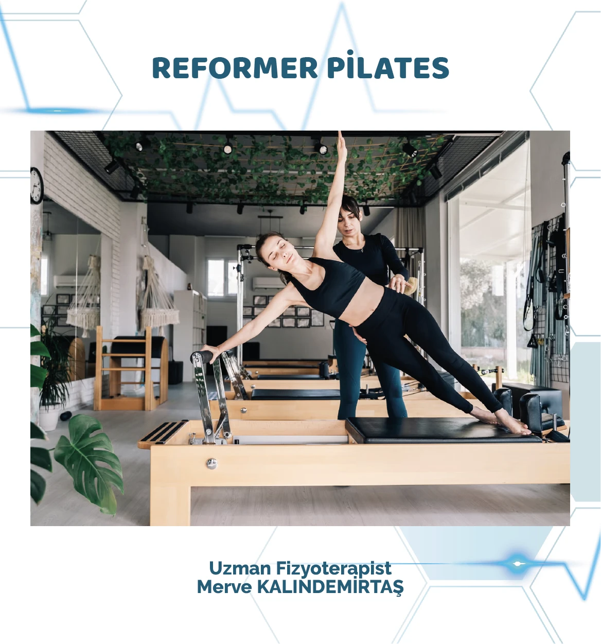 Reformer Plates